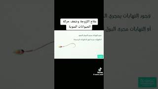 علاج اللزوجة وضعف حركة الحيوانات المنوية