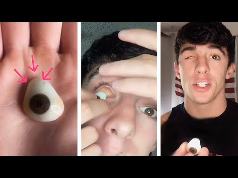 What It&rsquo;s Like To Have A Prosthetic Eye