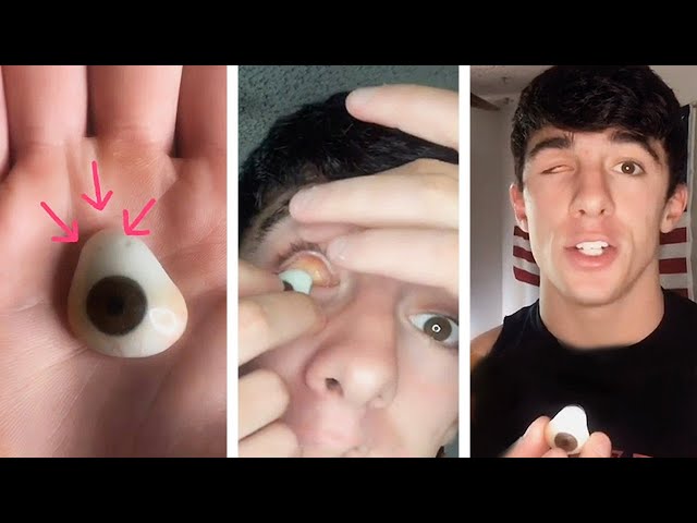 taking out my prosthetic eye and showing you what's behind it 