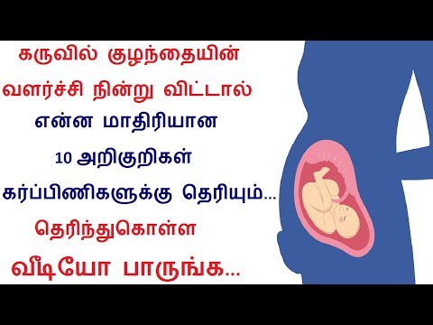 கருவில் குழந்தையின் வளர்ச்சி நின்று விட்டால் என்ன மாதிரியான 10 அறிகுறிகள் கர்ப்பிணிகளுக்கு தெரியும்