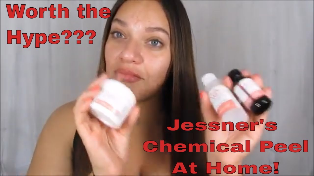 Jessner's Chemical Peel A First Impressions & Tutorial 
