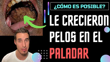 ¿Pueden crecer pelos en la lengua?