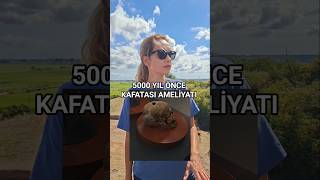 İkiztepe Höyüğünde Tunç Çağında Kafatası Ameliyatları