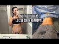 SURGERY DAY! LOOSE SKIN REMOVAL AFTER WEIGHT LOSS WITH DR. GAVIN DRY FROM ATHENIX | 360 BODY LIFT |