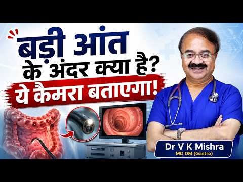 बड़ी आंत के अंदर क्या है? ये कैमरा बताएगा! | colonoscopy test