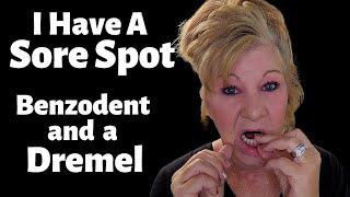 How To Fix A Sore Spot On My Gums From My DENTURES