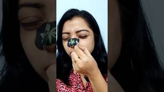 blackhead & whiteheads removal😱 #shortvideo#secrethacks #hack#ytshorts #shorts #diy #youtube #viral