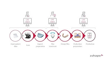 Workflow optimization in Clear Aligner Studio