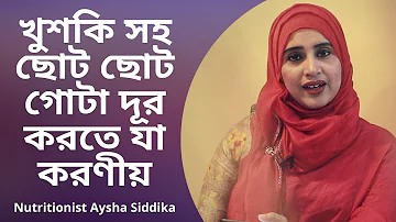 মাথার খুশকি সহ ছোট ছোট গোটা দূর করতে যা করণীয় |  |  Nutritionist Aysha Siddika | Shad o Shastho