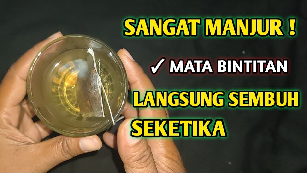 OBAT ALAMI MATA BINTITAN!! Cara Mengobati Mata Bintitan Paling Cepat