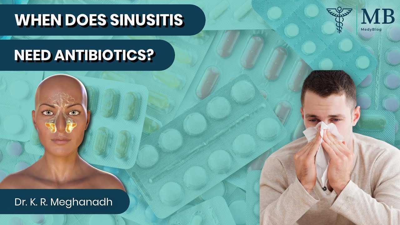 When Does Sinusitis Need Antibiotics Dr K R Meghanadh Medyblog when-does-sinusitis-need-antibiotics-dr-k-r-meghanadh-medyblog
