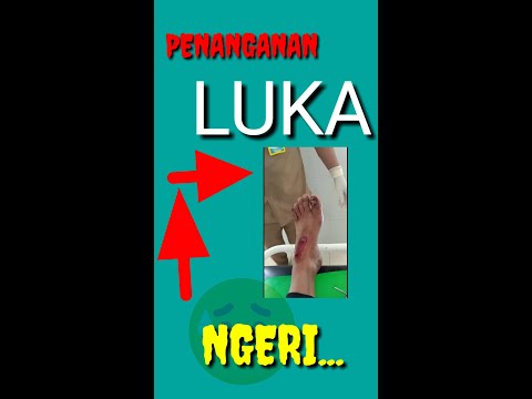 Mengganti perban luka pada jempol kaki pasca bedah kuku. 