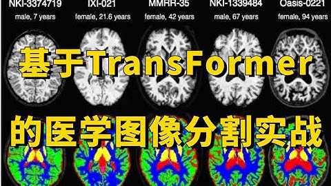 席卷CV界的Transformer到底有多牛！Swin-Unet：基于Transformer的医学图像分割实战，论文解读+源码复现 人工智能/机器学习/深度学习/神经网络/深度学习算法/深度学习入门