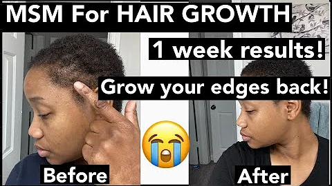 MSM Powder for Hair Growth results. Fine natural Thin short hair. How to grow back thinning edges.