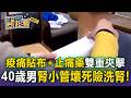 痠痛藥布.止痛藥「引爆急性腎危機」？！阿嬤連擦6週「這成分」急性腎衰竭【東森醫起看】【57健康同學會】