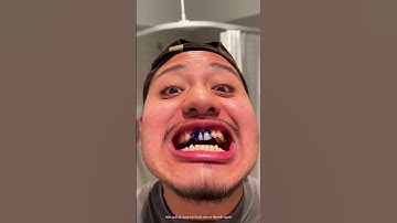 Nụ cười tỏa sáng cùng Mysmile