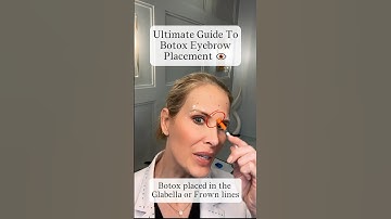 Ultimate Guide to Botox Eyebrow Placement 👁️ #botox #beauty #filler