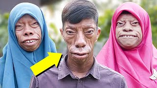 Meet The Family Whose Faces Change Shape (What Are They Hiding?)