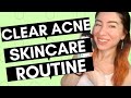 CLEAR ACNE Skincare Routine | All Skin Types