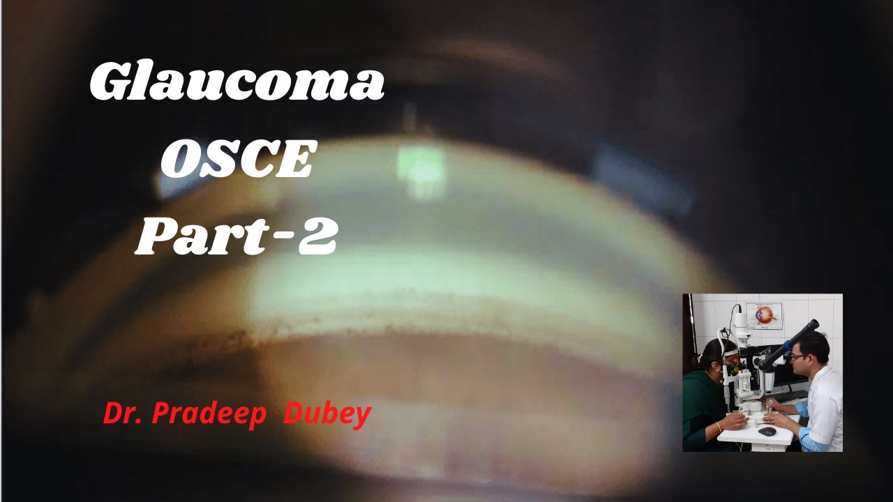 Glaucoma OSCE part 2 # Glaucoma diagnosis and management # Ophthalmology # PG Teaching program