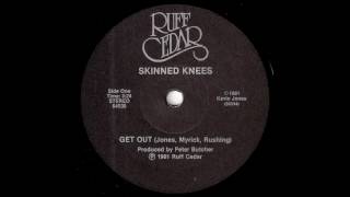 Skinned Knees - Get Out [Ruff Cedar] 1981 New Wave 45