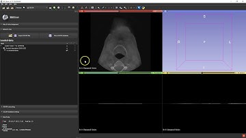 B4D Guide Module- 3D Slicer