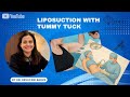 Liposuction with Tummy Tuck Surgery | Surgical Procedure Performed by Dr. Devayani Barve