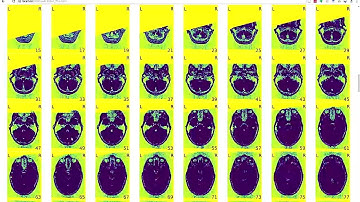OHBM 2018 | Educational Course | Reusing Public Neuroimaging Datasets | Part 3