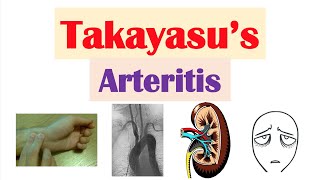 Takayasu’s Arteritis (Pulseless Disease) | Large Vessel Vasculitis |Symptoms, Diagnosis, Treatment