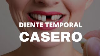 CÓMO HACER UN DIENTE PROVISIONAL CASERO /LORNA VELASCO 