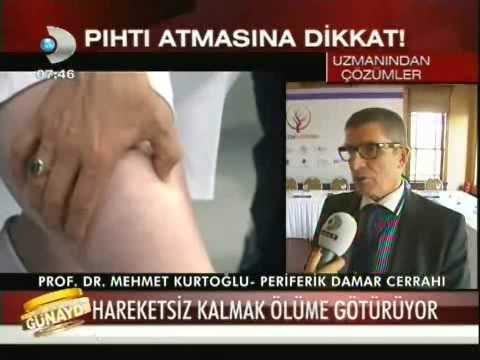 Video: Pitman kolumun yıprandığını nasıl anlarım?