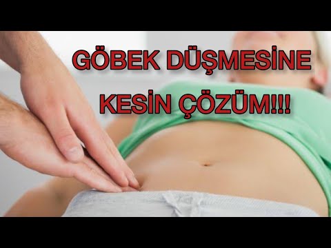 GÖBEK DÜŞMESİNE SON! Göbek Kayması Kaderiniz Değil