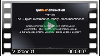 DynaMesh®-SIS direct soft - OR-Video: TOT 8/4 - Surgical Treatment of Urinary Stress Incontinence screenshot 4