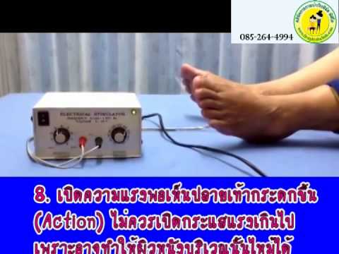 ตอนที่31: เครื่องกระตุ้นกล้ามเนื้อ Electrical Stimulator