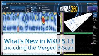 What’s New in MXU 5.13: Introducing Merged B-Scan