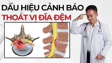 Dấu hiệu cảnh giác Thoát Vị Đĩa đệm bạn nên quan tâm | Bác Sĩ Trần Minh