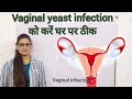 Vaginal yeast infectionhome remedies