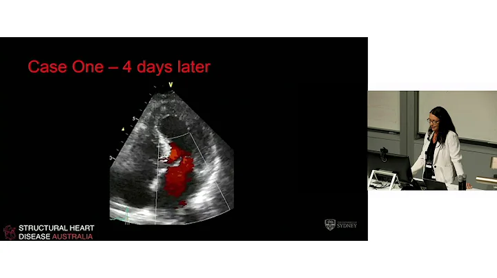 Acquired Left Ventricular Pathology - Dr Julie Hum...