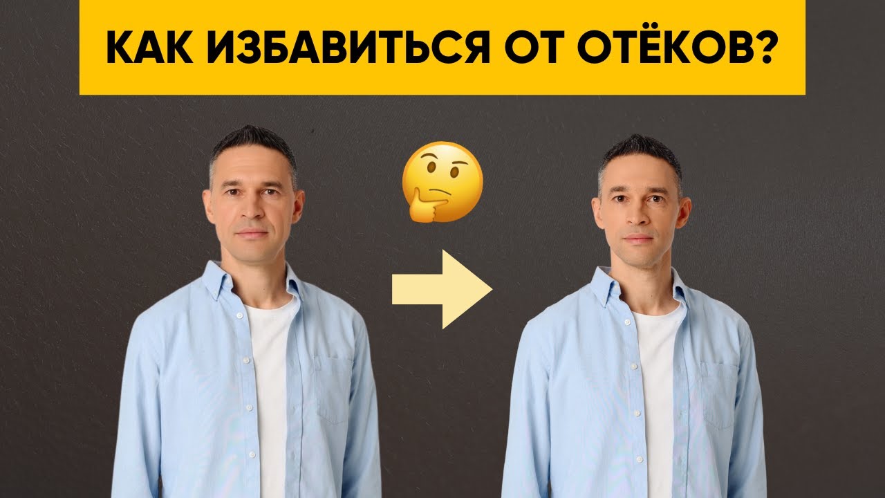 КАК ИЗБАВИТЬСЯ ОТ ОТЁКОВ?