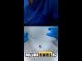 5 Ways Malaria Literally Rewired Human DNA to Save Us #Shorts