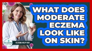 What Does Moderate Eczema Look Like On Skin?