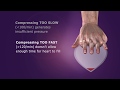 Conventional CPR Overview