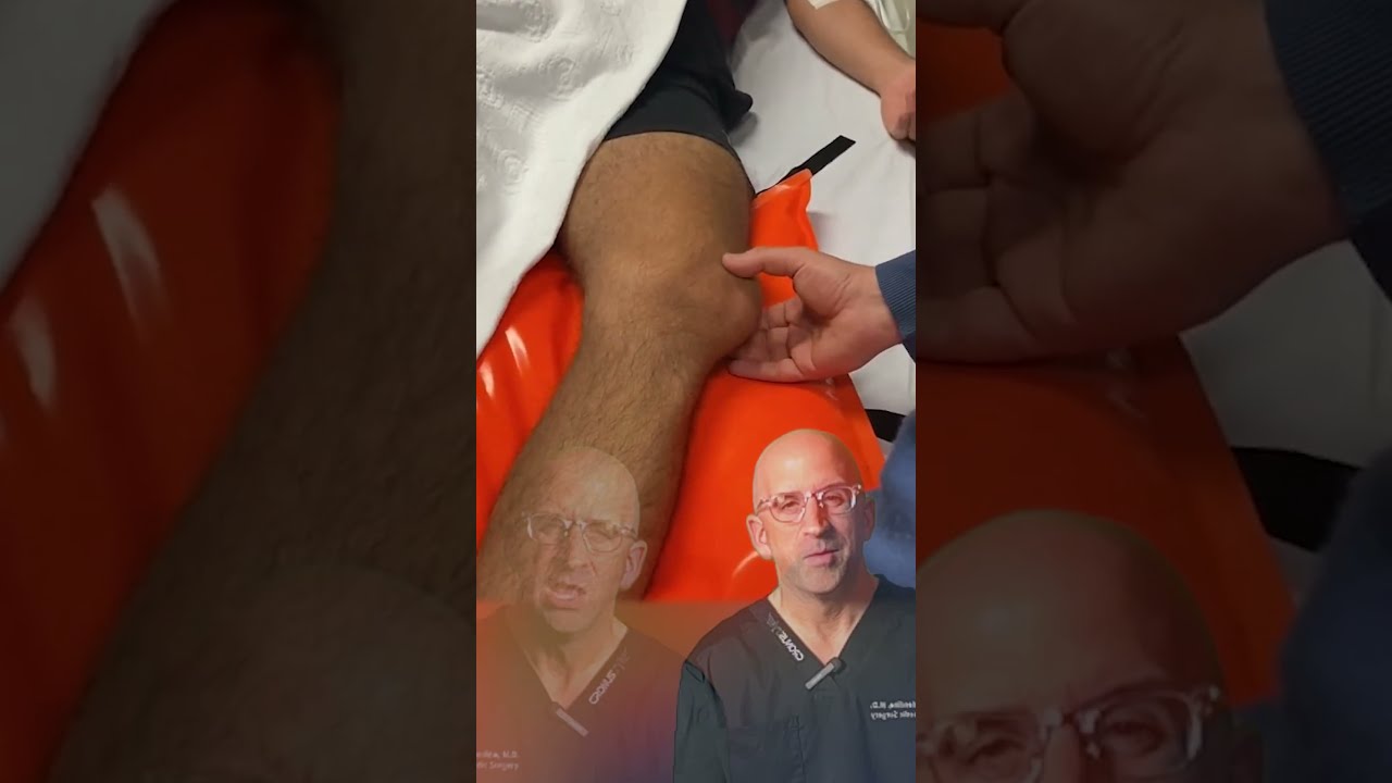 Kneecap Dislocation Symptoms Causes And Reduction Techniques Shorts