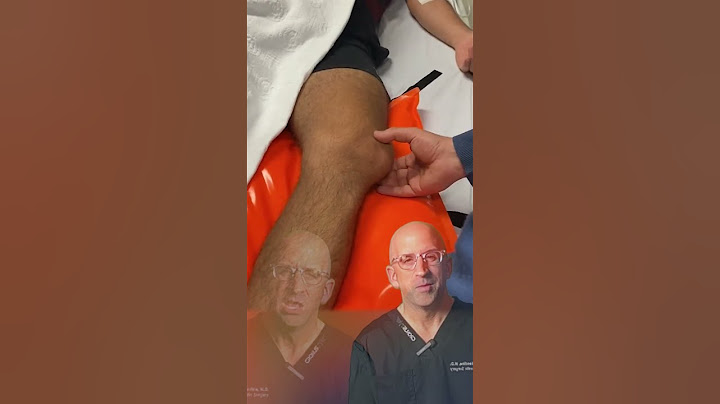 Kneecap Dislocation: Symptoms, Causes, and Reduction Techniques #shorts