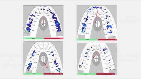 Evaluating Closures with T-Scan: Part 2