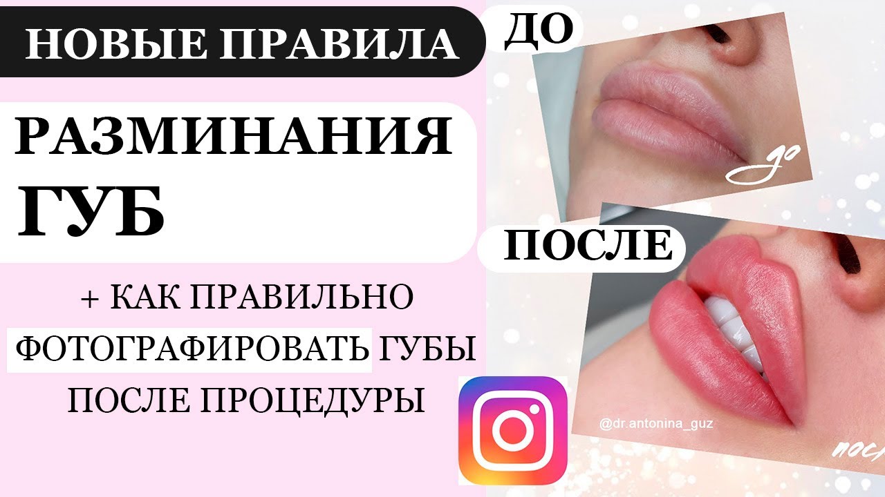 Новые правила РАЗМИНАНИЯ ГУБ после контурной пластики / Как фотографировать губы  после увеличения - YouTube