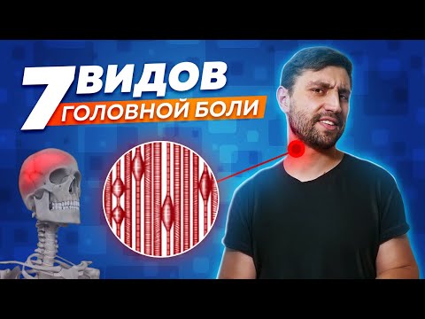 Почему болит голова? 7 видов головных болей