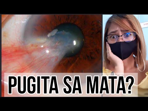 Video: Bakit Ang Mga Mata Ng Pugita Ay Hindi Pangkaraniwan