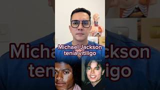 Vitiligo La Enfermedad Que Tuvo Michael Jakcson  Dr William Guerrero medicina shorts