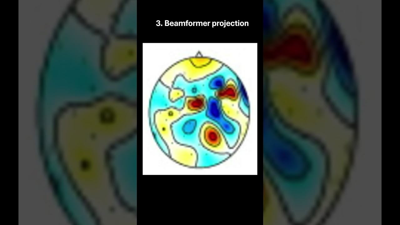 MEG data acquisition and processing